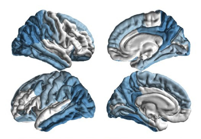 USC leads global consortium of researchers for NIH funded study on Parkinson’s disease